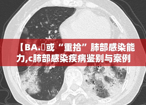 【BA.無或“重拾”肺部感染能力,c肺部感染疾病鉴别与案例剖析】