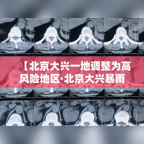 【北京大兴一地调整为高风险地区·北京大兴暴雨积水点】 【北京大兴一地调整为高风险地区·北京大兴暴雨积水点】