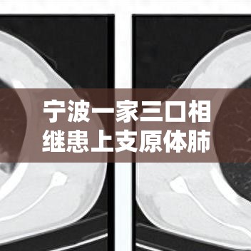 宁波一家三口相继患上支原体肺炎—(支原体肺炎防治9个提醒) 宁波一家三口相继患上支原体肺炎—(支原体肺炎防治9个提醒)