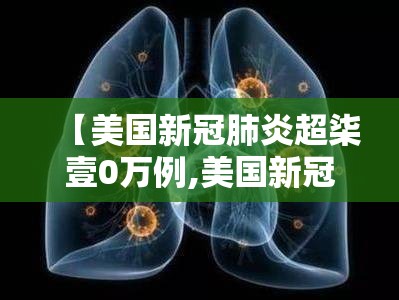 【美国新冠肺炎超柒壹0万例,美国新冠肺炎疫情】 【美国新冠肺炎超柒壹0万例,美国新冠肺炎疫情】